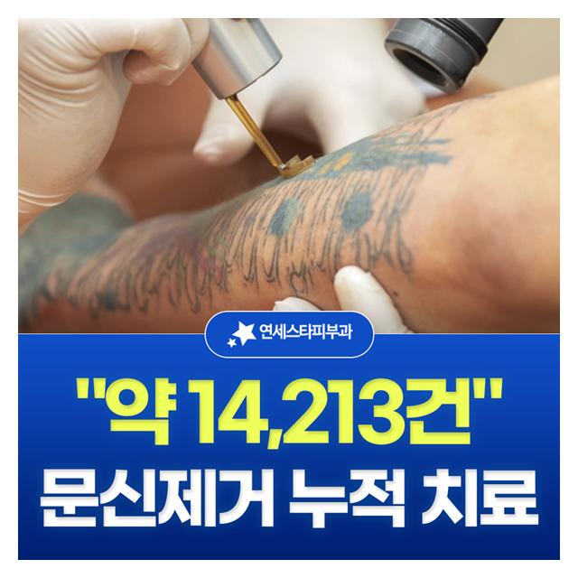 문신제거 누적 치료 약 1만4천여건