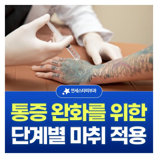 통증 완화를 위한 단계별 마취 적용